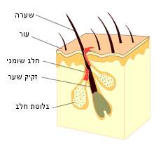 אקנה &ndash; פצעי בגרות